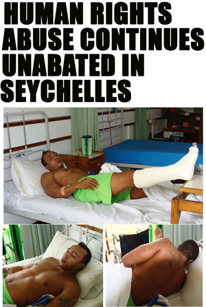 Human Rights abuse in Seychelles