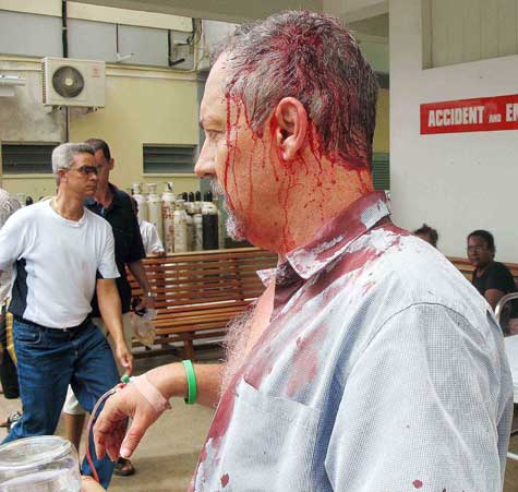 Jean Francois beaten by police.