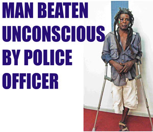 Headline - disabled man beaten unconscious by police.