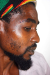 Mervin Samedi beaten up by police.